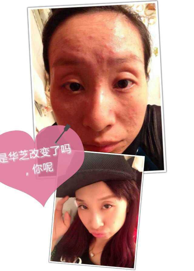 14C1F2C3B59D820E098096D51CBF8E1F.png