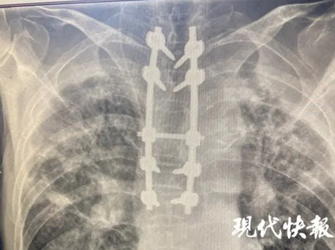 QQ20201010-171827@2x.png